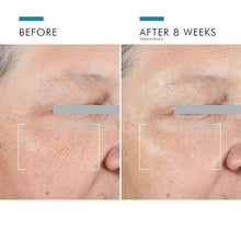 Skinceuticals A.G.E. Advanced Eye 15 ml