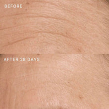 before and after study of gm collin bota peptide cream