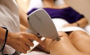 Laaser Hair REmoval with Light Sheer Diode Laser at The Summit-Skin CAre & Hair REmoval