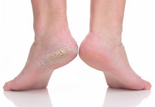 Footlogix #3+ Cracked Heel Formula