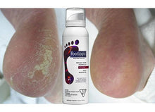 Footlogix Rough Skin Formula Trial Size, 1.18 oz