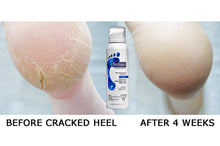 Footlogix #3+ Cracked Heel Formula