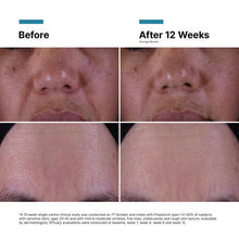 Skinceuticals P-TIOX Cream 48 ml