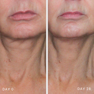gm collin 4d visible lifting neck serum before and after